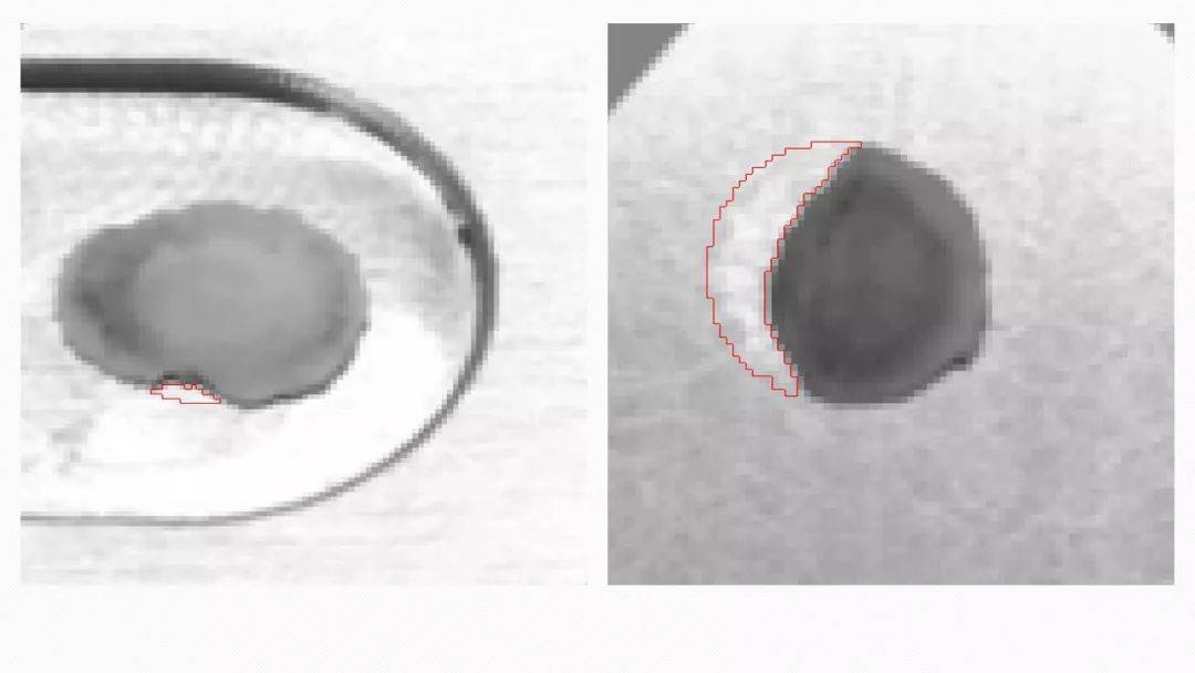 振子蘑菇头的缺陷(图4) 振子蘑菇头的缺陷(图4)